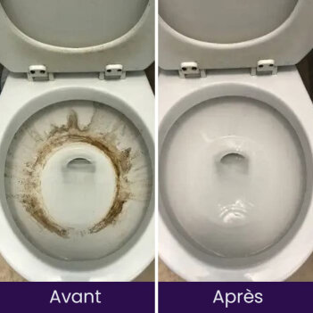 NuroClean image
