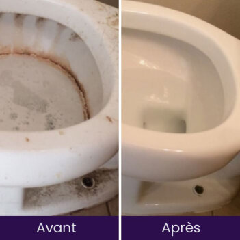 NuroClean image
