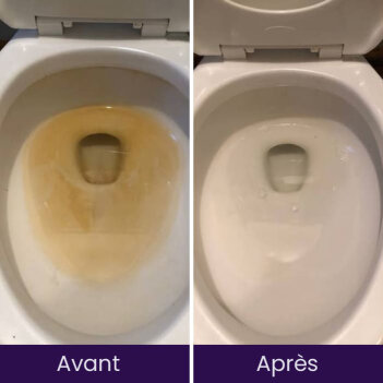 NuroClean image