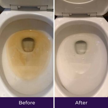 NuroClean image