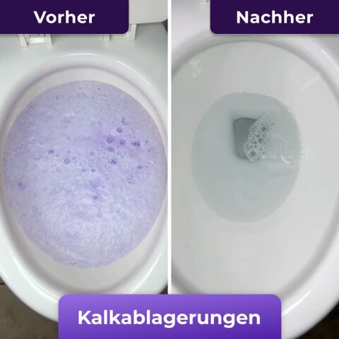 NuroClean image