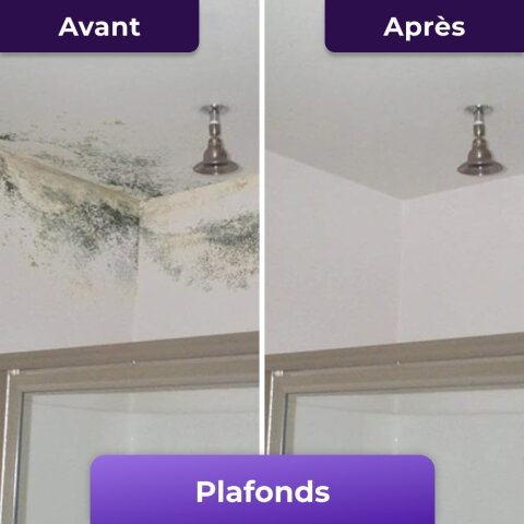 NuroClean image